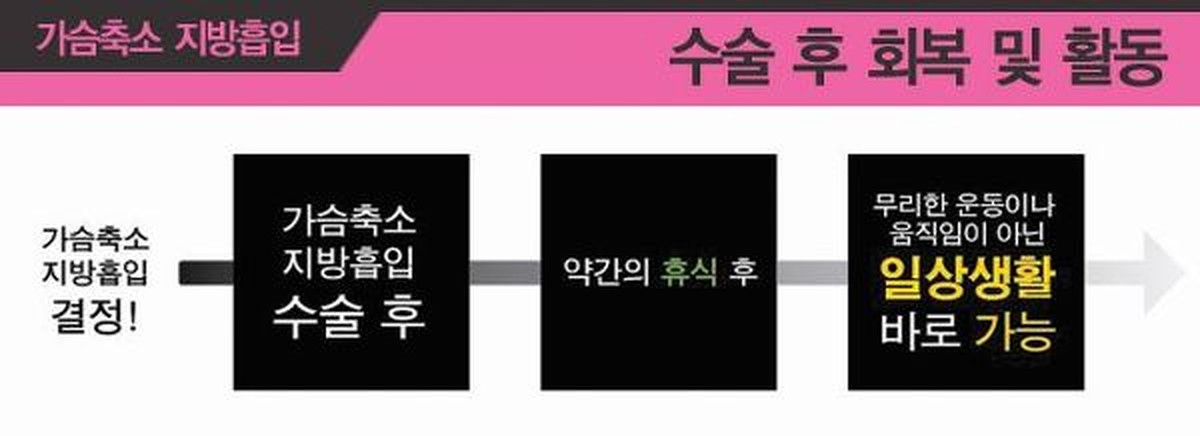 가슴축소 지방흡입 수술 후 회복 및 일상복귀 타임라인