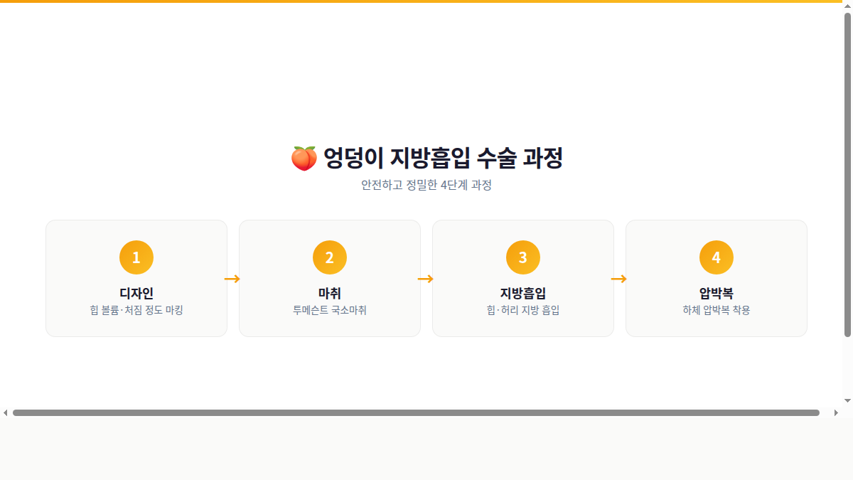 엉덩이 지방흡입 수술 과정 인포그래픽 4단계
