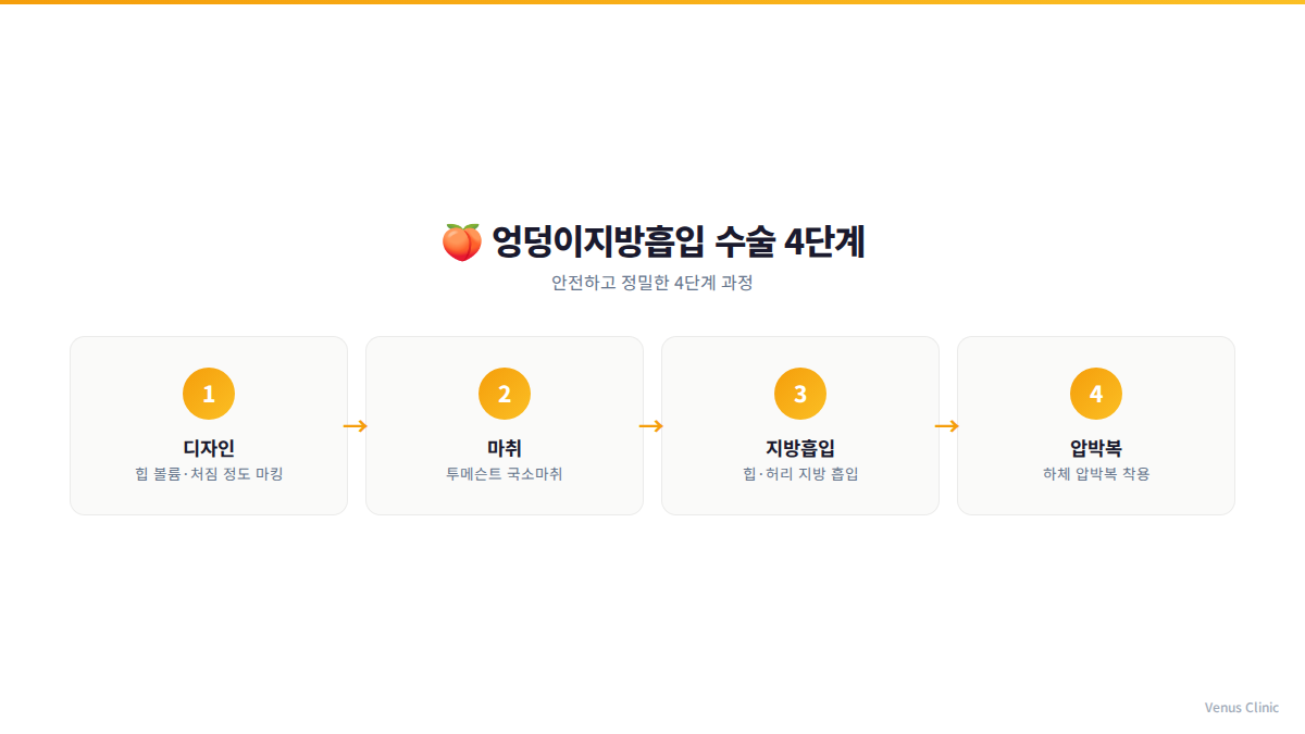 엉덩이지방흡입 수술 4단계 인포그래픽