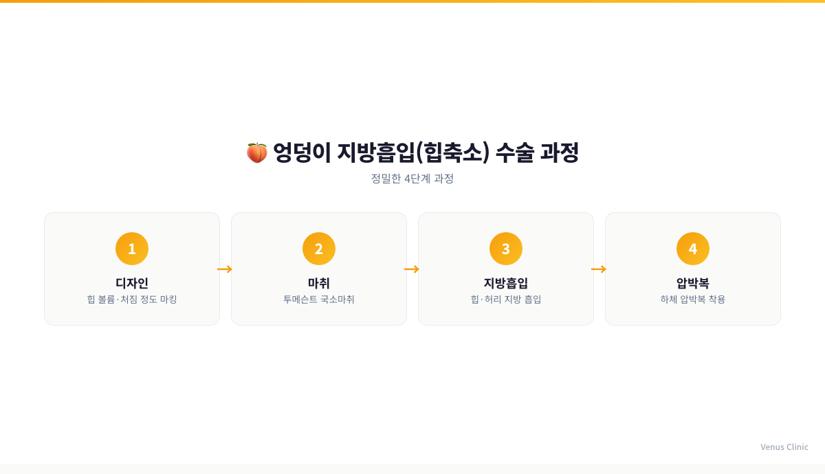 엉덩이 지방흡입 수술 과정 4단계 인포그래픽 - 디자인, 마취, 지방흡입, 압박복