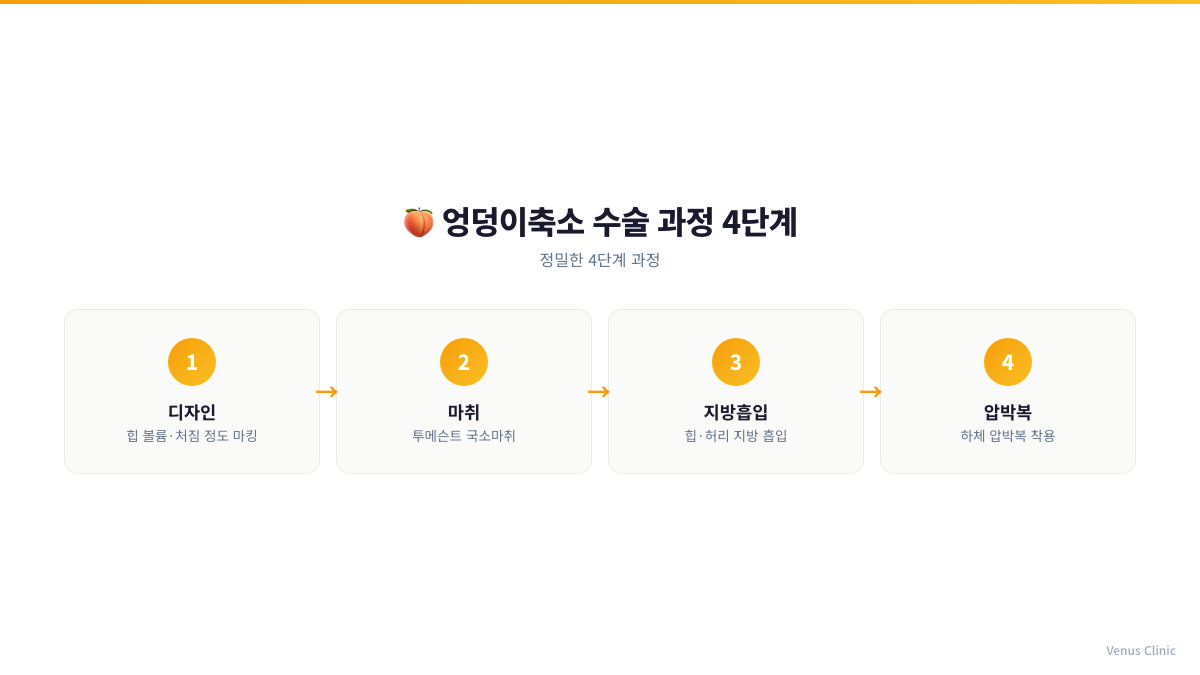 엉덩이축소 수술 과정 4단계를 정리한 인포그래픽