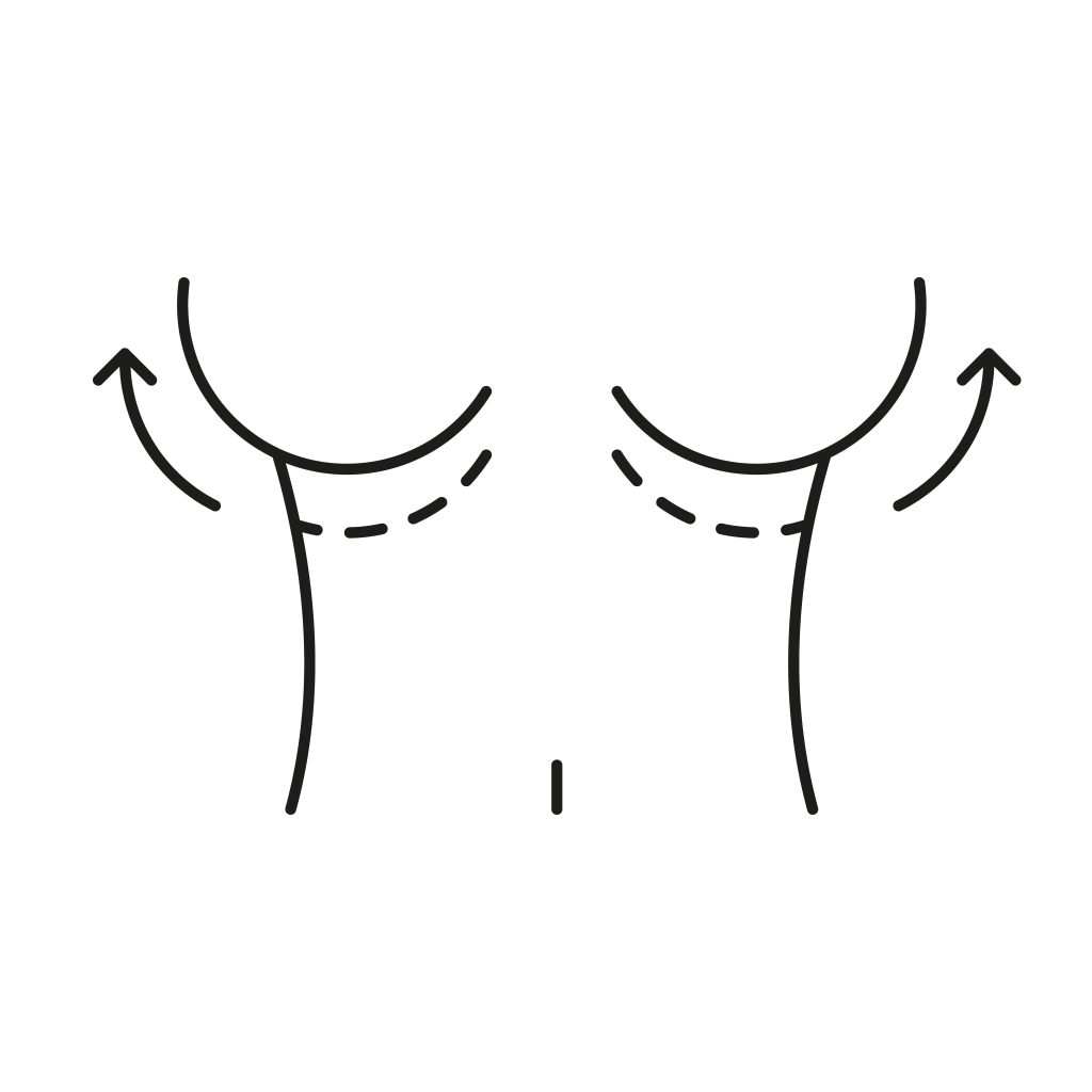 부유방과 겨드랑이 지방흡입 부위를 보여주는 이미지