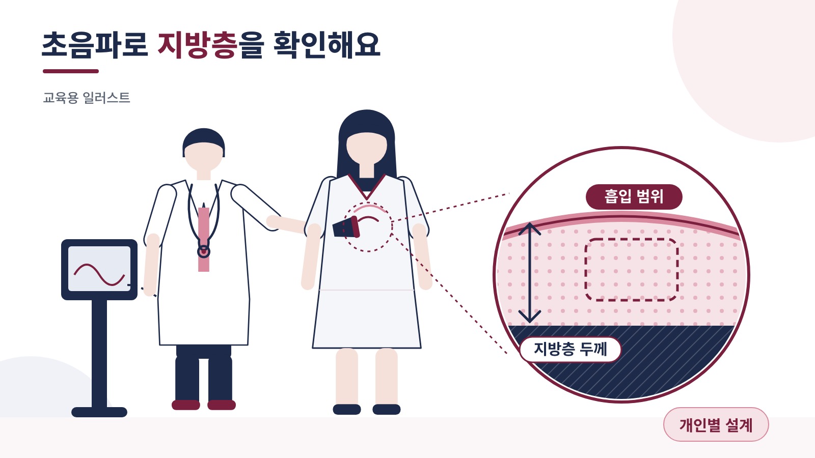 초음파로 지방층 두께를 확인한 뒤 흡입 범위를 설계하는 과정을 보여주는 교육용 일러스트