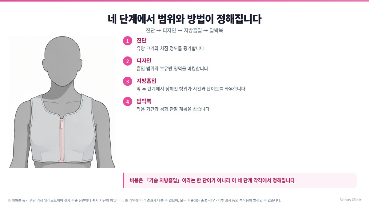 유방하수 가슴 지방흡입 네 단계 인포그래픽 — 진단·디자인·지방흡입·압박복이 범위와 비용에 반영되는 과정