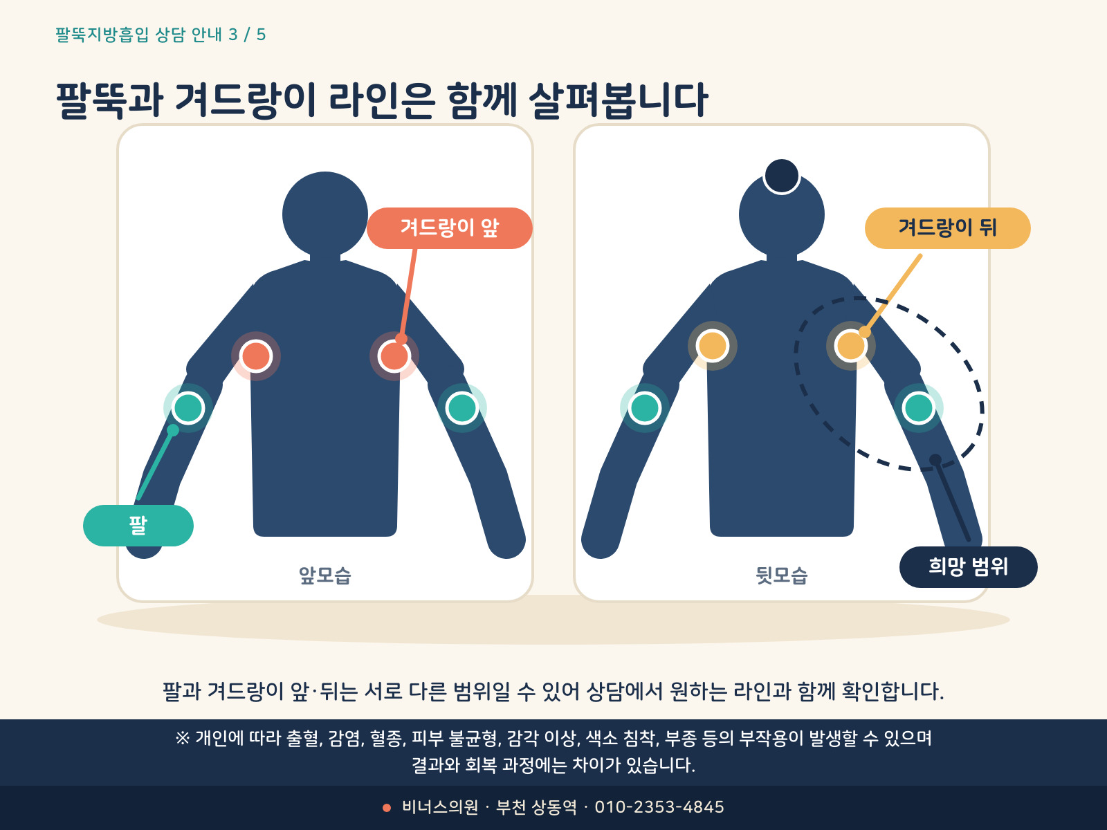 팔과 겨드랑이 앞뒤 범위를 함께 살펴보는 의료 인포그래픽