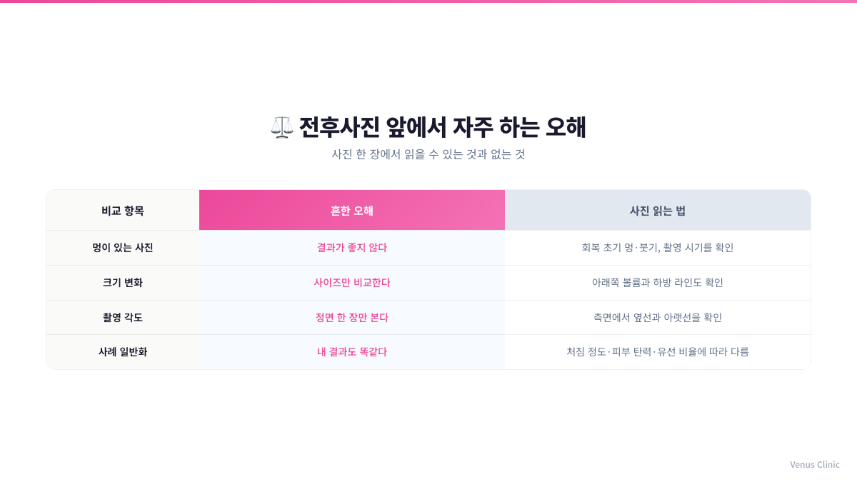 전후사진 앞에서 자주 하는 오해와 사진 읽는 법을 비교한 인포그래픽